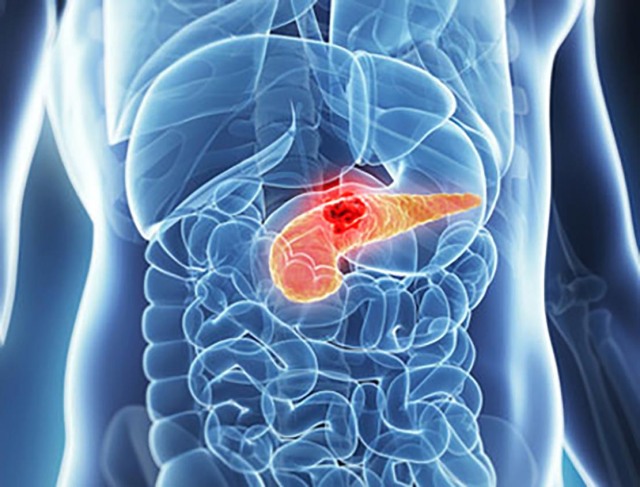 Pierderea a doar 1 gram de grăsime în pancreas poate inversa diabetul de tip 2