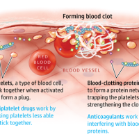 "Blood thinners": Anticoagulante si Antiagregante plachetare
